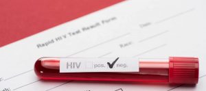 aids hastalığı belirtileri