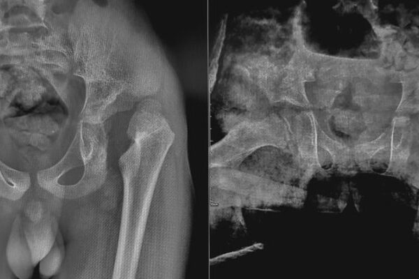 HSG (Rahim) Filmi Önce Dikkat Edilmesi Gereken 5 Şey