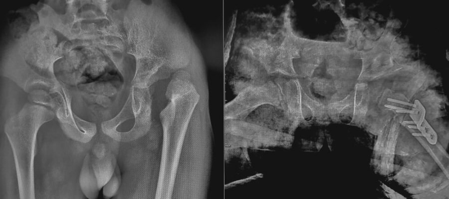 HSG (Rahim) Filmi Önce Dikkat Edilmesi Gereken 5 Şey