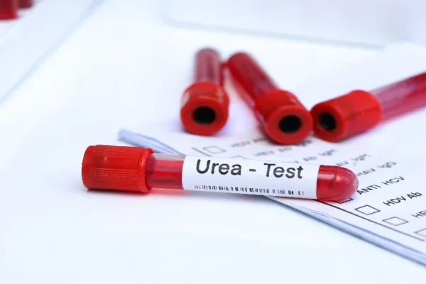 Üre Testi