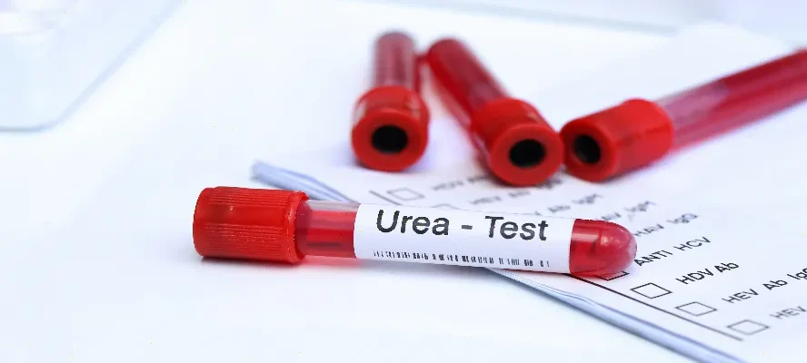 Üre Testi