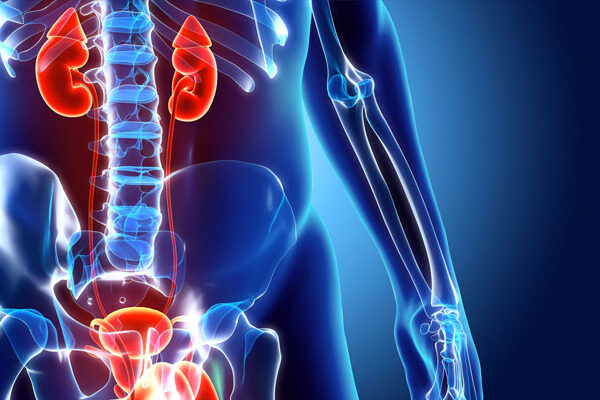Voiding Sistoüretrografi