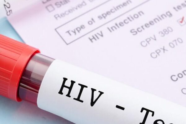 Aids Bulaşma Yolları