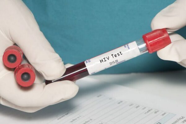 Aids Nasıl Bulaşır?