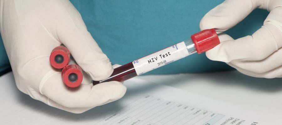 Aids Nasıl Bulaşır?