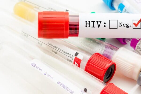 Aids Testi Nedir?