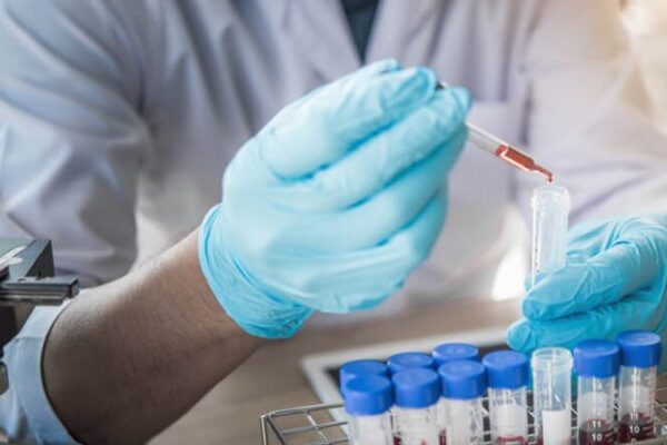 Aids Testi Ne Zaman Yapılmalıdır?