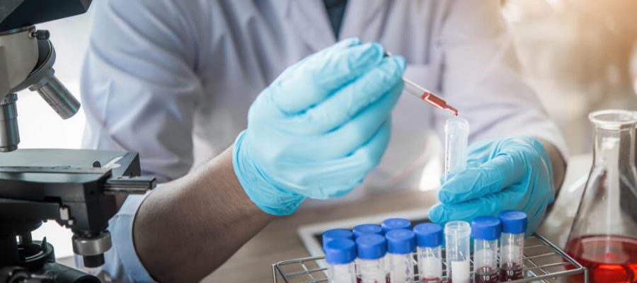 Aids Testi Ne Zaman Yapılmalıdır?