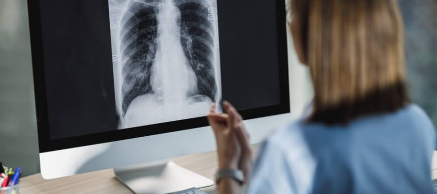 Akciğer Tomografisi