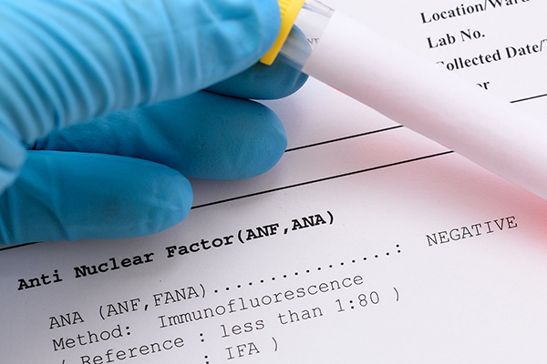 Anti Nükleer Antikor Testi