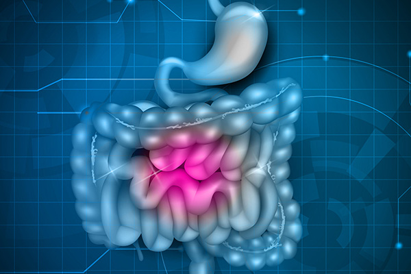 Fekal Kalprotektin Testi