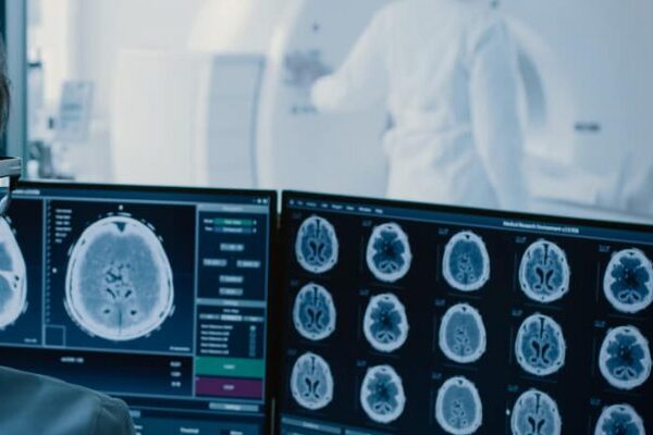 Bilgisayarlı Tomografi