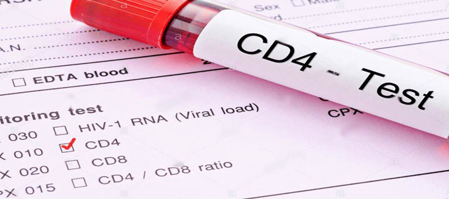 CD4 Testi