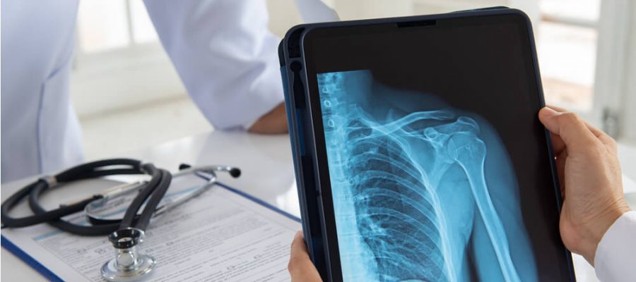 Dijital Röntgen