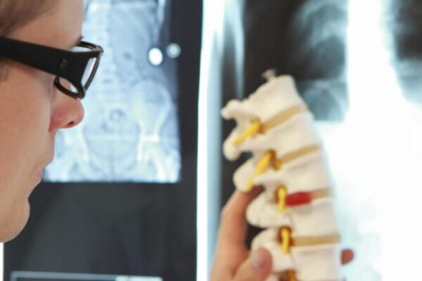 Herniografi (Fıtık) Filmi