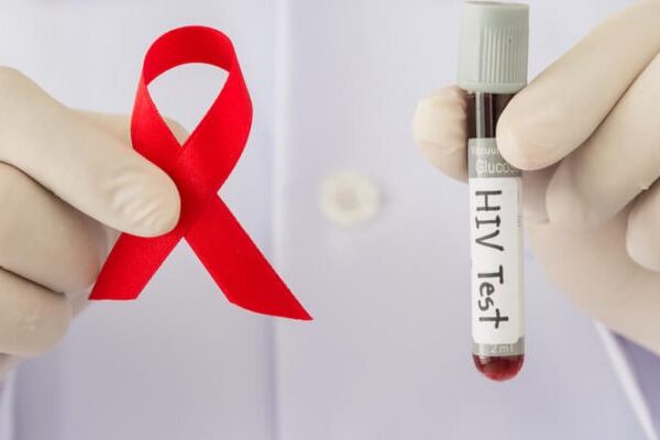 Hiv PCR Testi