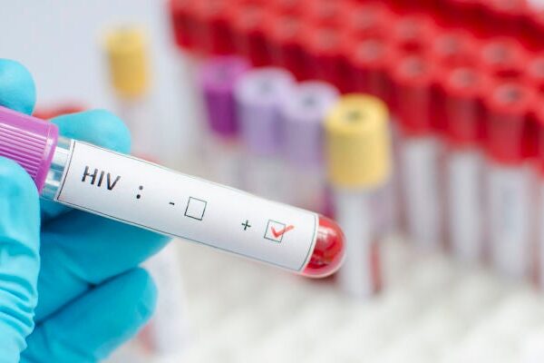 Hiv Testi