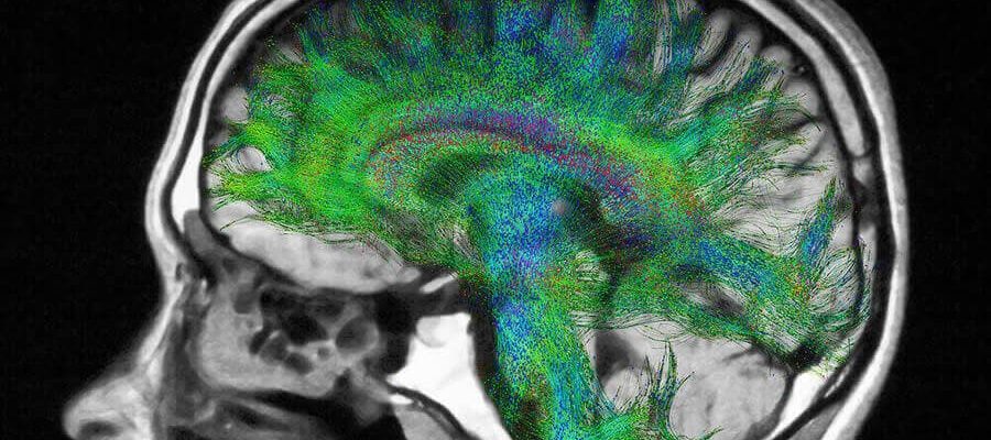 MR Tensör ve Traktografi