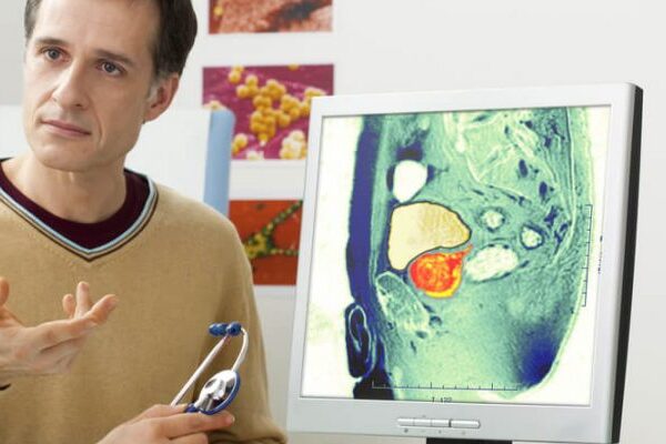 Multiparametrik Prostat MR