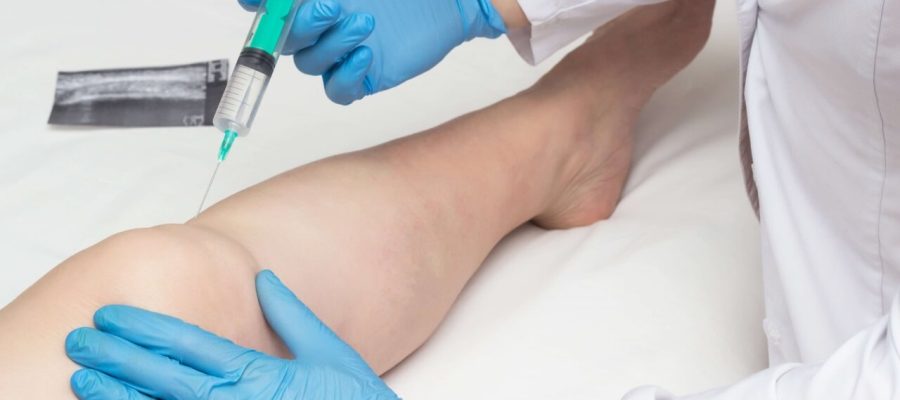 Proloterapi (Şekerli Su Tedavisi)