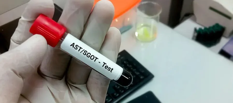 SGOT (AST) Testi