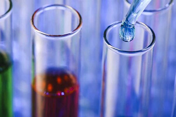 Makroprolaktin Testi