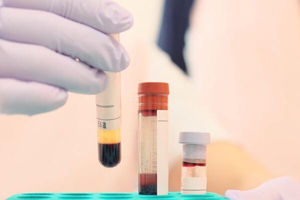 Sperm Spermiogram Kruger Testi