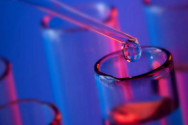 VDRL Kolesterol Testi