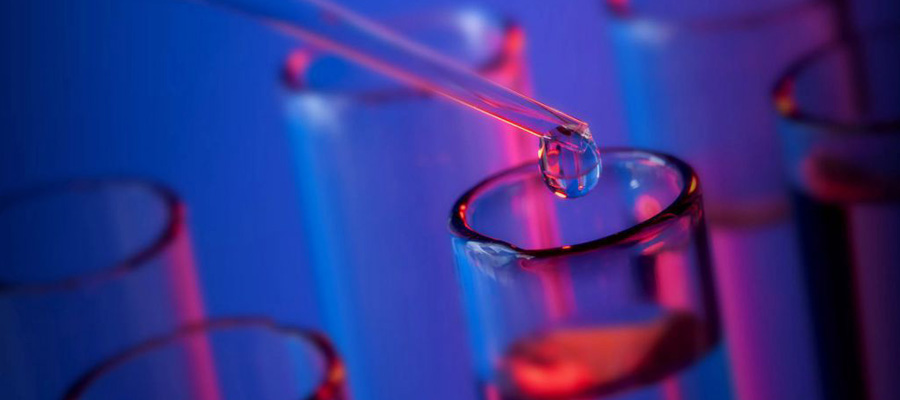 VDRL Kolesterol Testi