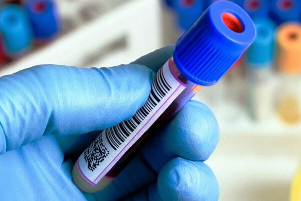 CRP Testi