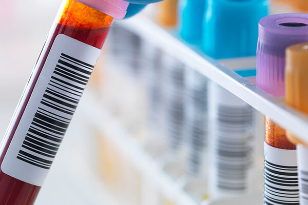 Demir Bağlama Testi