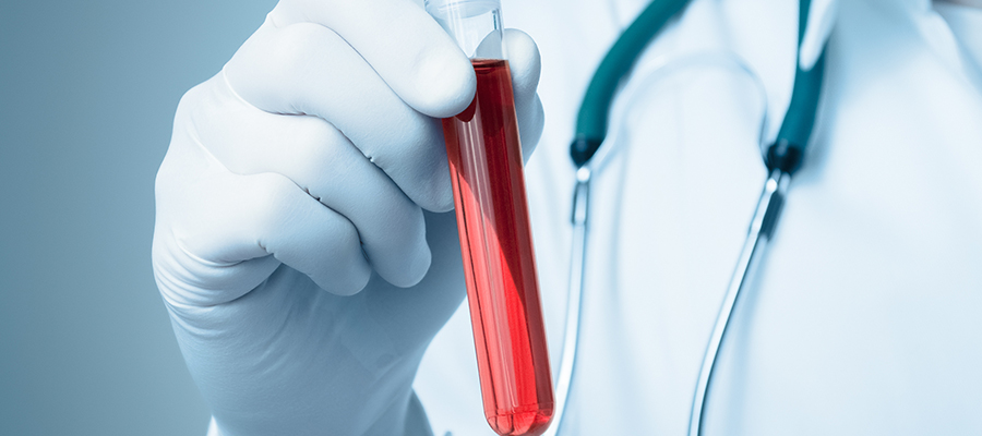 Faktör II Protrombin Testi