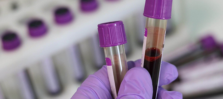 Gaitada Gizli Kan Testi