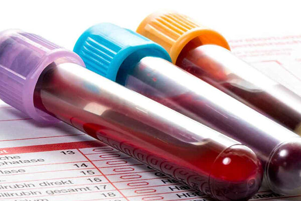 Gıda İntolerans Testi