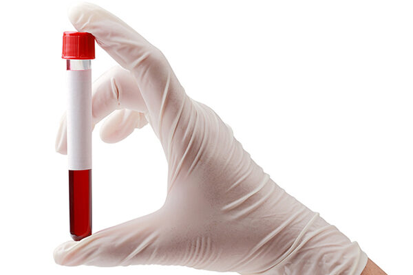 Hemoglobin Testi