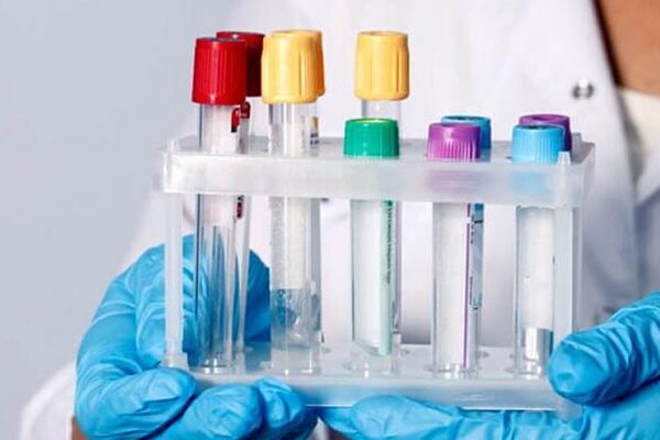 Kültür Antibiyogram Testi