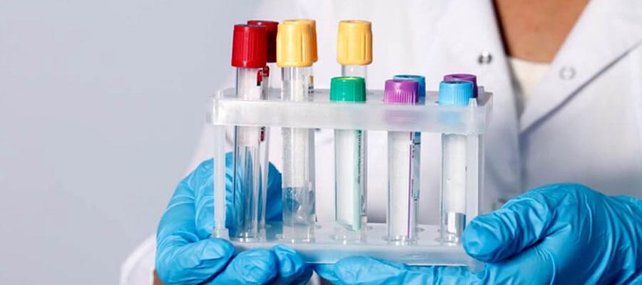 Kültür Antibiyogram Testi