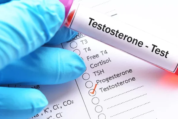 Testosteron Testi