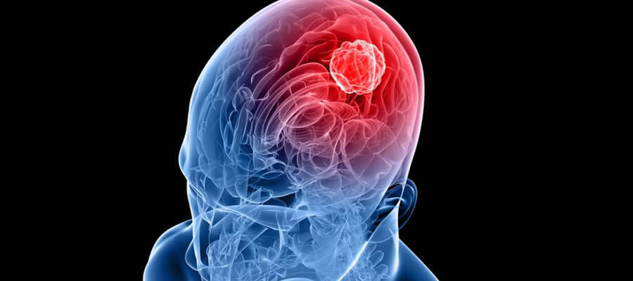 Transfontanel Ultrason