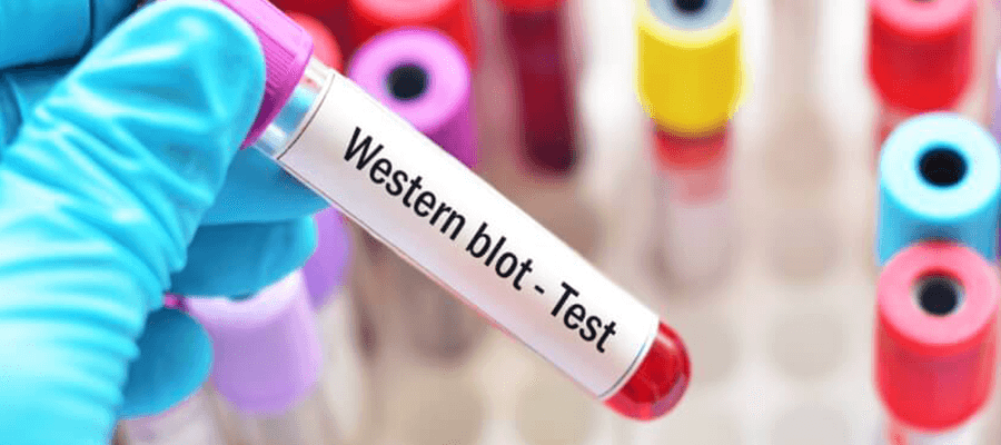 Western Blot Testi